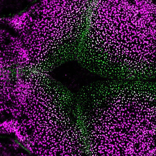 MAX_22-03-10_foxc1bgal4_mcherryNTR_angptl1b_DMSO ON at 5dpf_0.5x_10x_12.8mm_A4_corrected